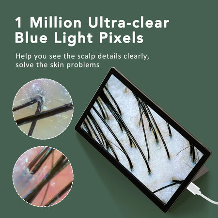 Skin Analyzer Dermatoscope &ndash; Ultra Clear Imaging Tech