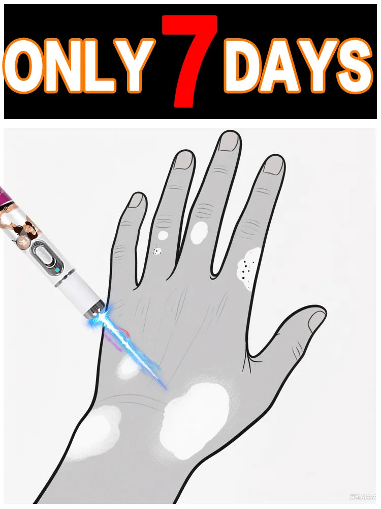 Vitiligo Behandlingsenhet Uppgraderad Version Fotplåster Snabb