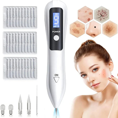 Skin Tag Remover LED Plasma Pen &ndash; Safe Quick Spot Removal