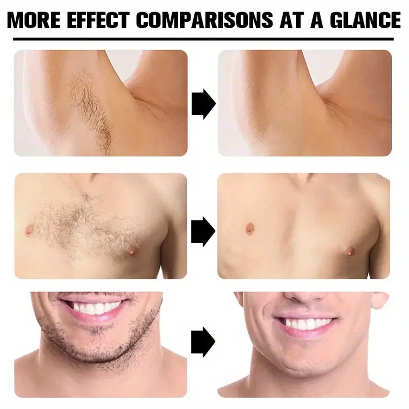 Water Ice Levin Hair Removal Cream &ndash; Painless and Permanent Hair Removal