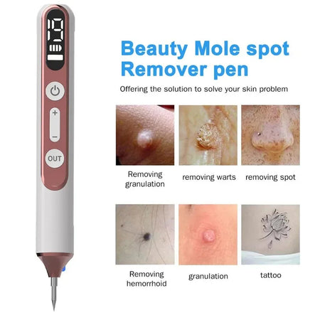 Skin Tag Remover Laser Plasma Pen &ndash; Warts Eliminator