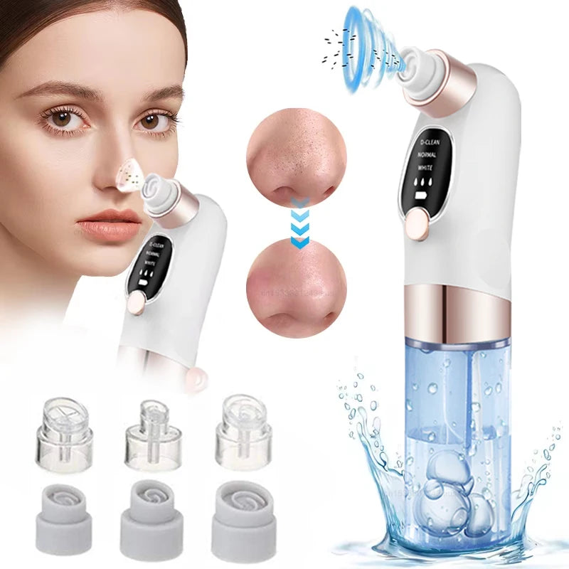 Electric Blackhead Remover Pore Cleaner, Acne Extractor for Clear Skin