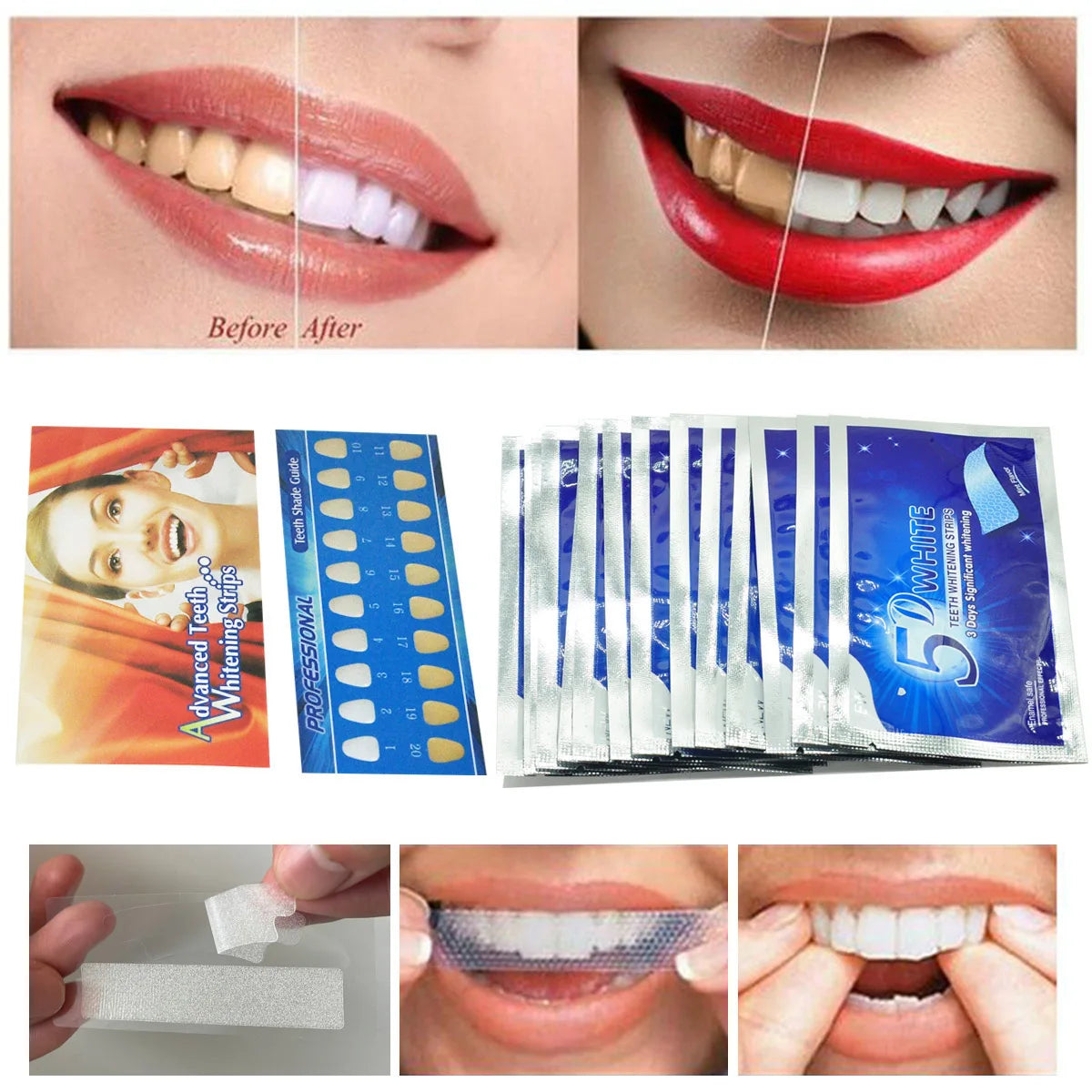 5D Gel Teeth Whitening Strips &ndash; Effective Whitening for False Teeth and Veneers