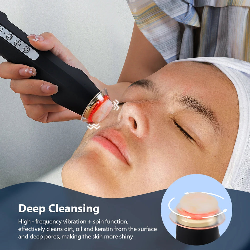 Oxygen Bubble Pen CO2 Facial Machine &ndash; Skin Rejuvenation