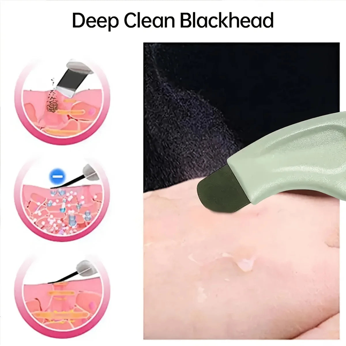 Facial Blackhead Removal Tool | Deep Cleansing &amp; Acne Removing Beauty Care