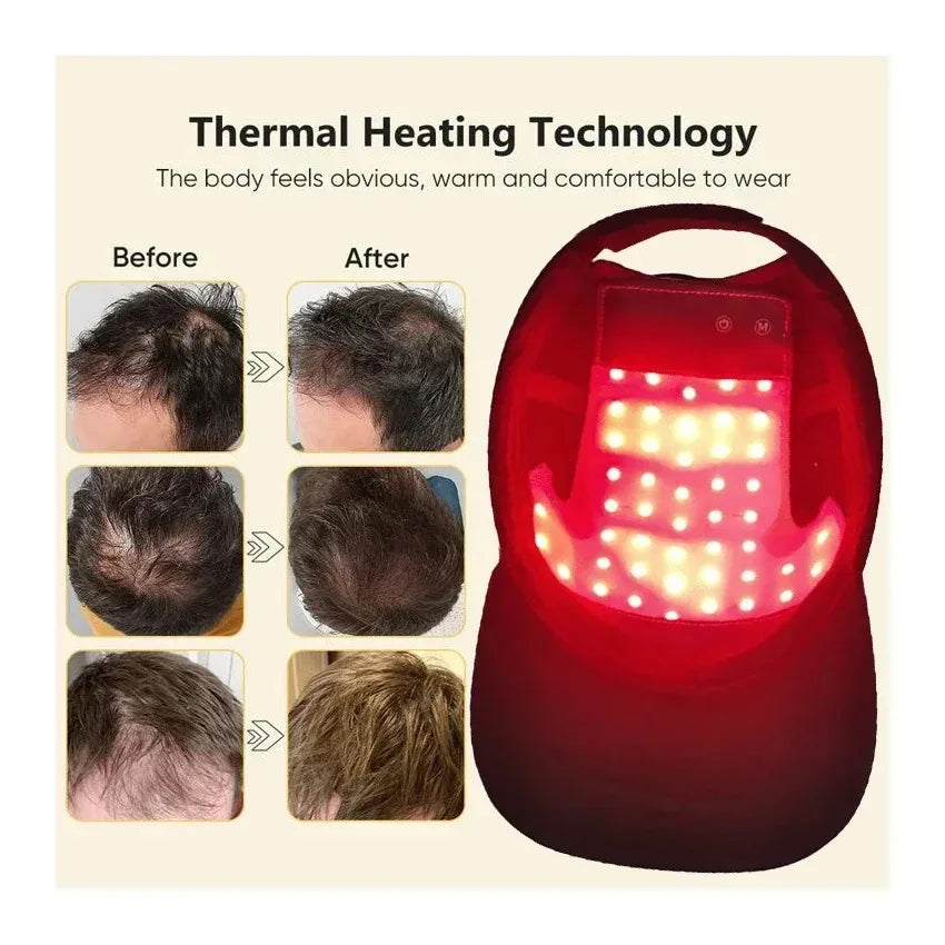 LED Red Light Therapy Cap &ndash; Hair Regrowth Booster Pro