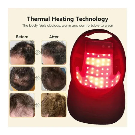 LED Red Light Therapy Cap &ndash; Hair Regrowth Booster Pro