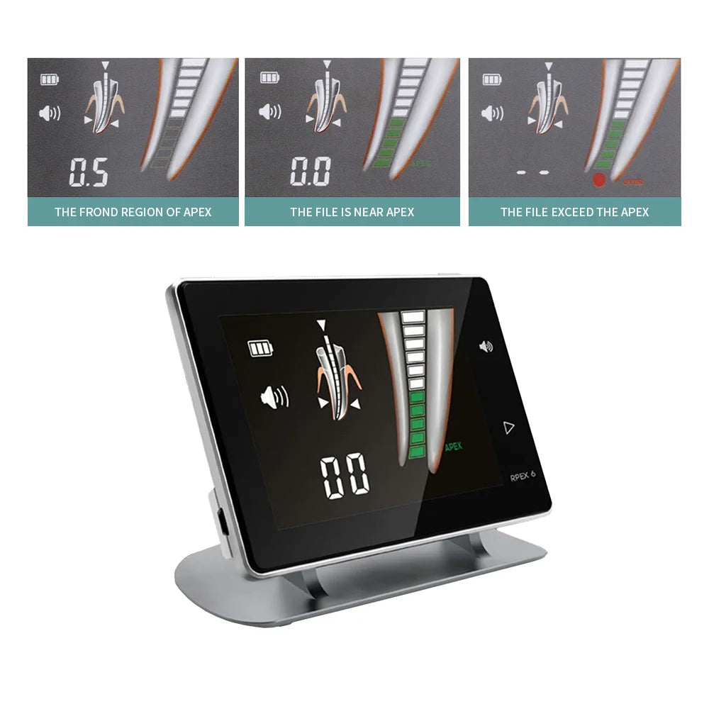 AZDENT Endo Apex Locator LCD &ndash; Portable Root Canal Meter