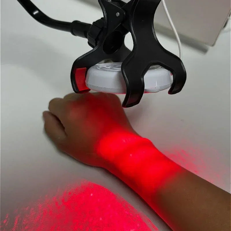 Domácí USB studený laserový terapeutický přístroj 650nm 808nm úleva od bolesti