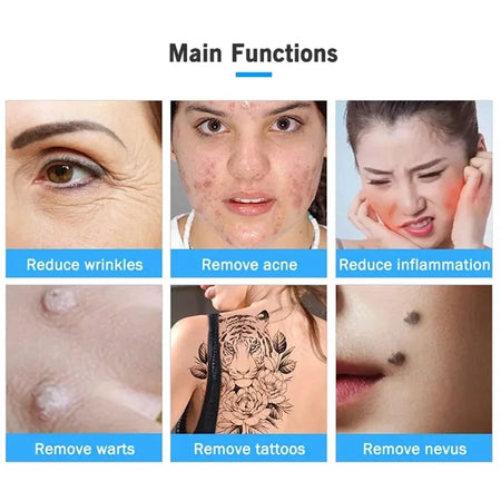 Professional 2 In 1 Ozone Plasma Pen - Mole Removal