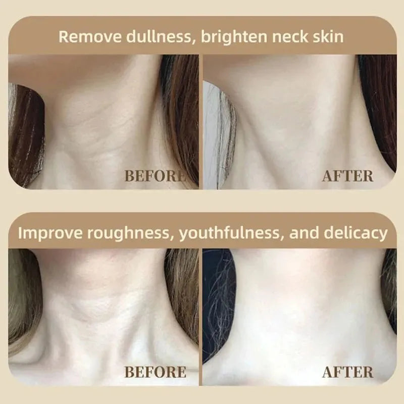 Vilnason Neck Chest LED Mask Infrared - Skin Rejuvenation