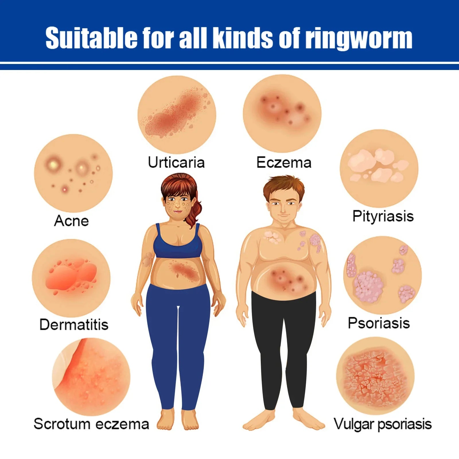 UVB Vitiligo Therapy Light UV311nm Lamp &ndash; Clinical UV Lamp