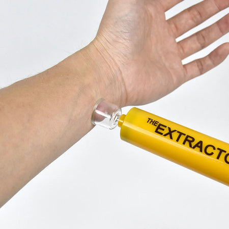 Gmarty Venom Extractor Vacuum Pump &ndash; Outdoor Venom Removal