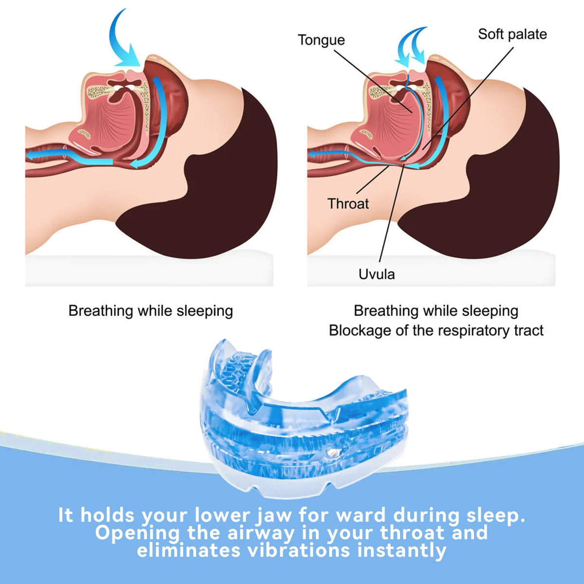 Anti Snore Bruxism Mouth Guard | Stop Snoring &amp; Sleep Aid
