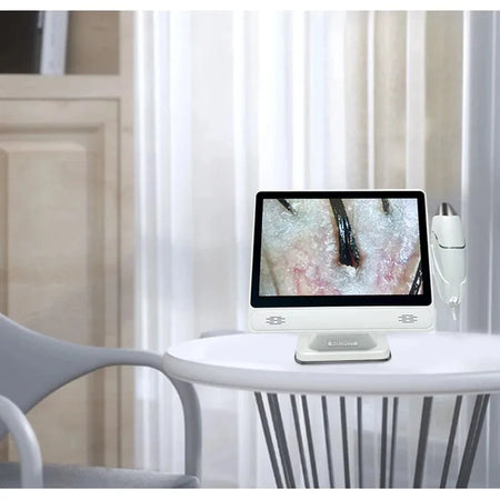 HD Digital Skin Analyzer Pro &ndash; Hair Follicle Detector