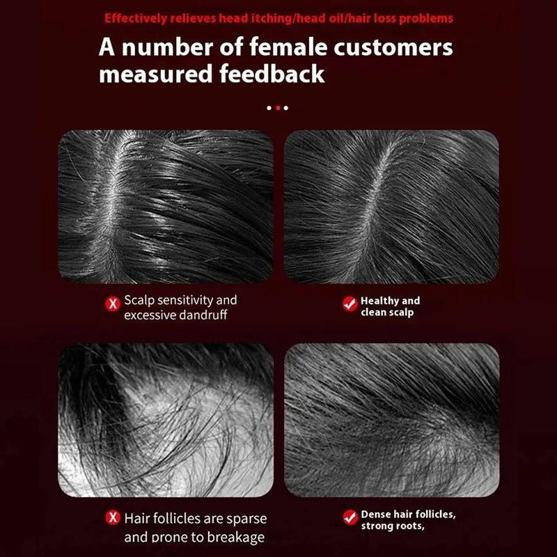 Vilnason Electric Vibration Massage Comb &ndash; Red Light Mode