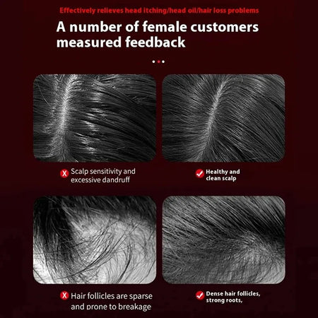 Vilnason Electric Vibration Massage Comb &ndash; Red Light Mode