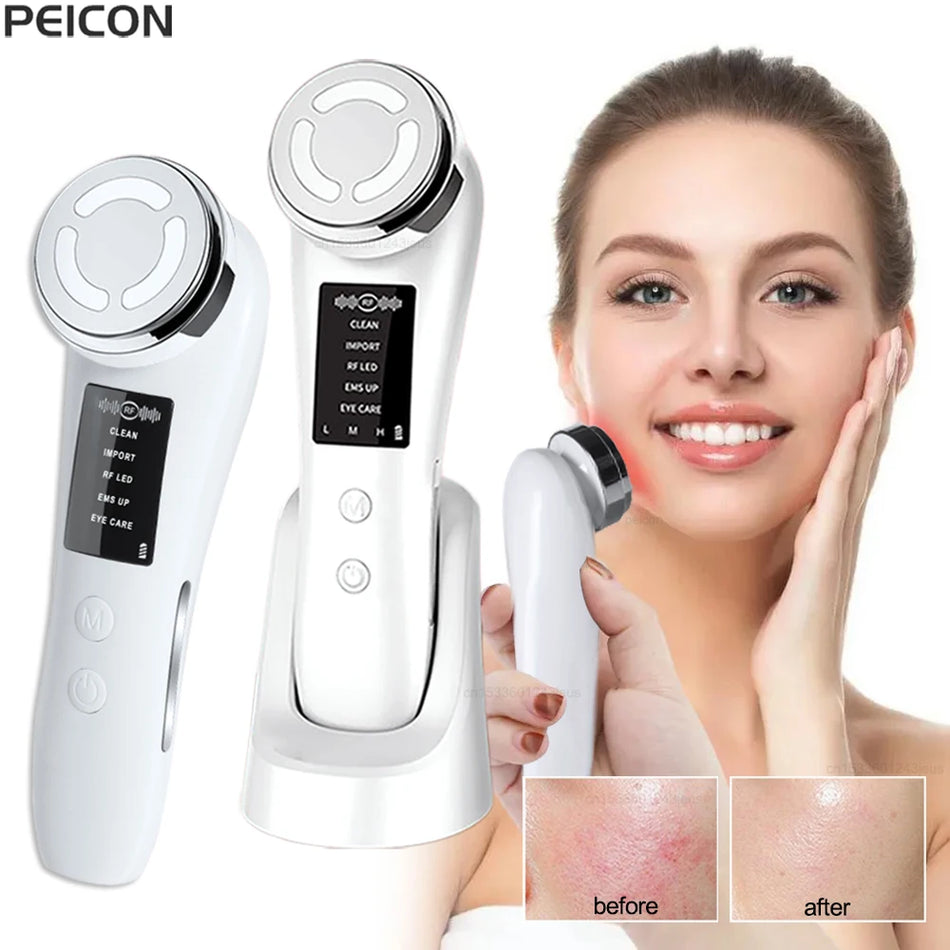 RF Facial Massager for Skin Tightening and Lifting with EMS Microcurrent