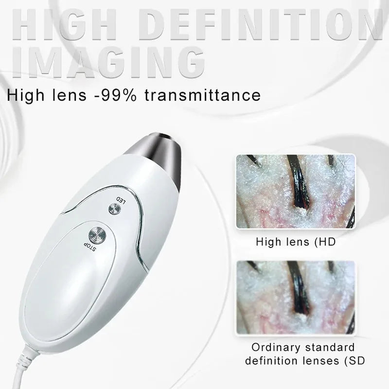 HD Digital Skin Analyzer Pro &ndash; Hair Follicle Detector