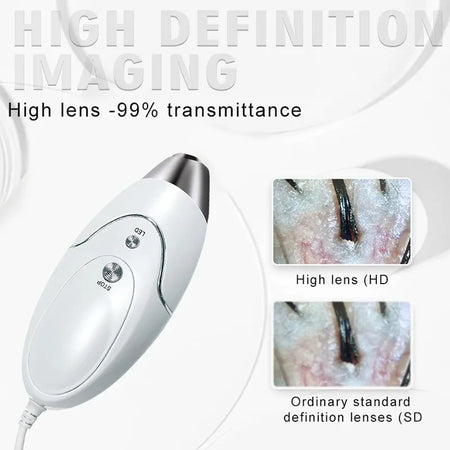 HD Digital Skin Analyzer Pro &ndash; Hair Follicle Detector