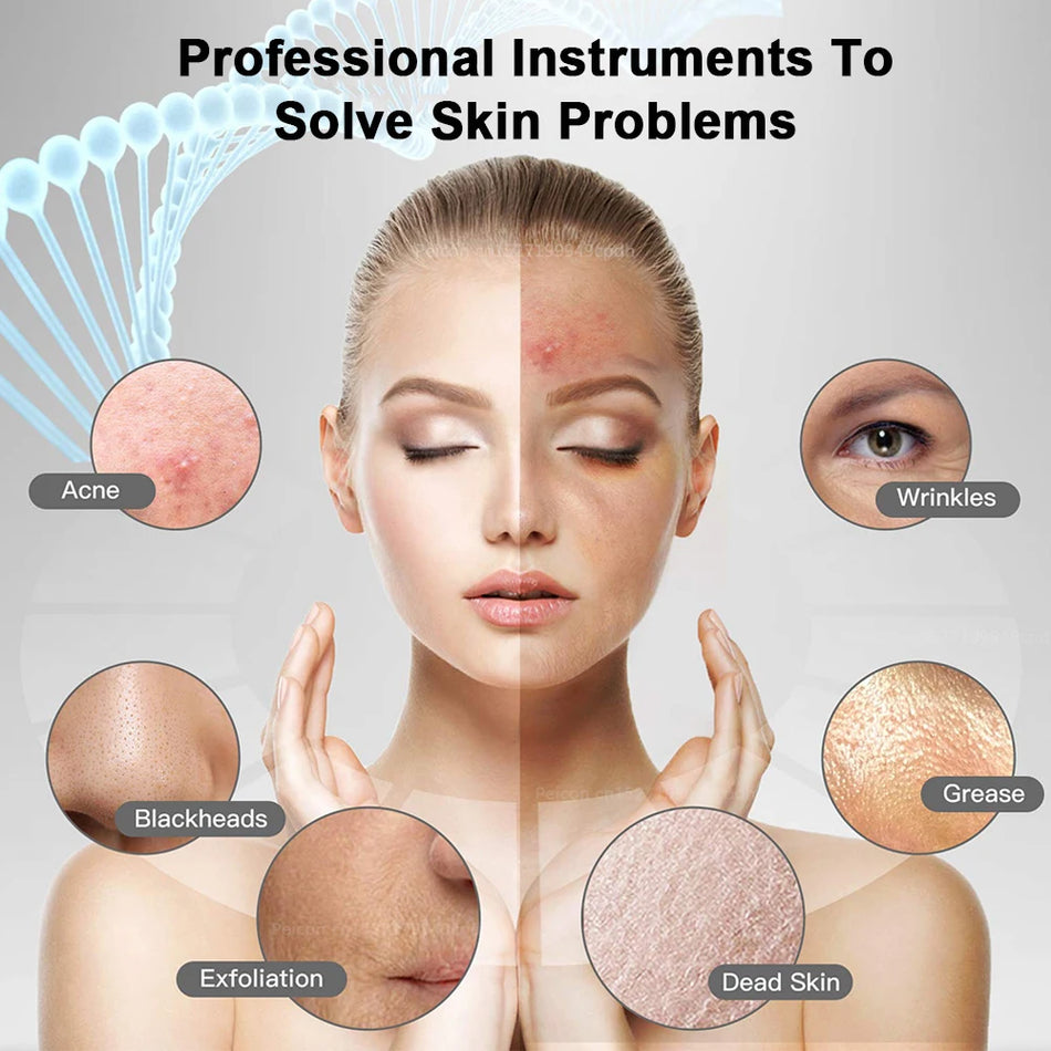 Ultraschall-Gesichtsschaber für tiefe Gesichtsreinigung, Poren- und Mitesserentfernung