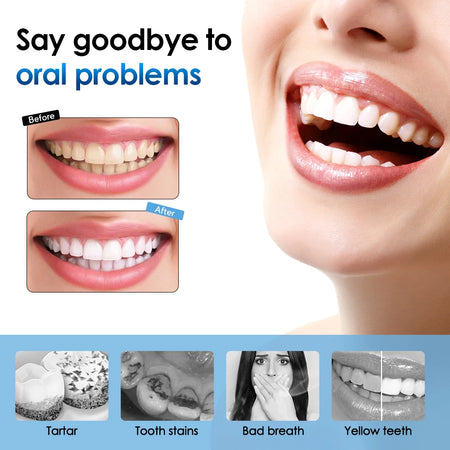 Electric Teeth Cleaner - High Frequency Cleaning Benefit