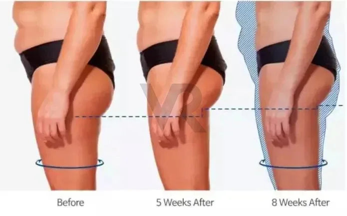 Certificato CE 6 In 1 Aspirapolvere Per Perdita Di Peso Cavitazione Forma Del Corpo