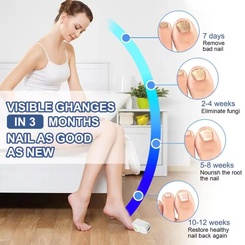 Laserová terapie nehtové plísně s modrým LED světlem pro nehty na nohou
