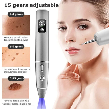 Laser Plasma Pen &ndash; All-In-One Skin Tag Wart Remover