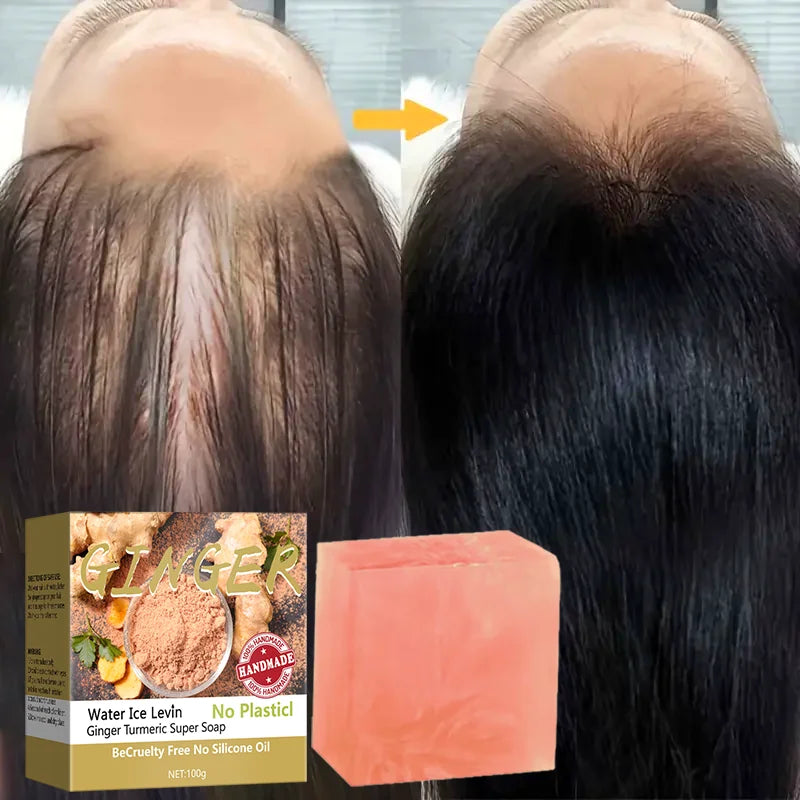 Ginger Turmeric Super Soap &ndash; Antimicrobial Hair Treatment