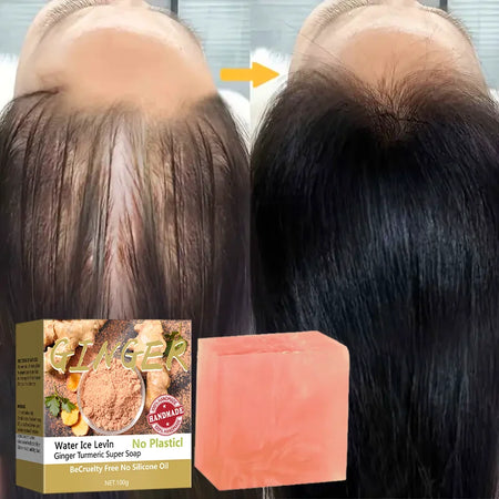 Ginger Turmeric Super Soap &ndash; Antimicrobial Hair Treatment