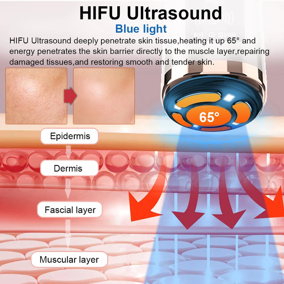 Machine de lifting facial Hifu avec microcourant EMS pour le rajeunissement de la peau