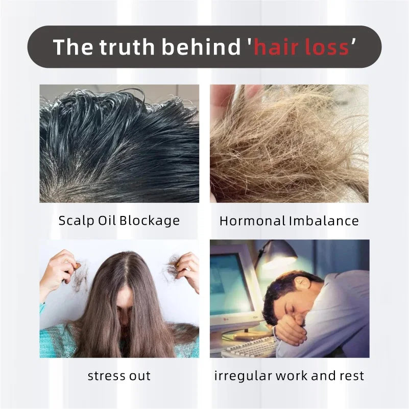 Καπέλο Ανάπτυξης Μαλλιών με 120 LED Κόκκινου Φωτός και 8 Λέιζερ για Πιο Δυνατά και Πυκνότερα Μαλλιά στο Σπίτι Καπέλο Θεραπείας με Λέιζερ