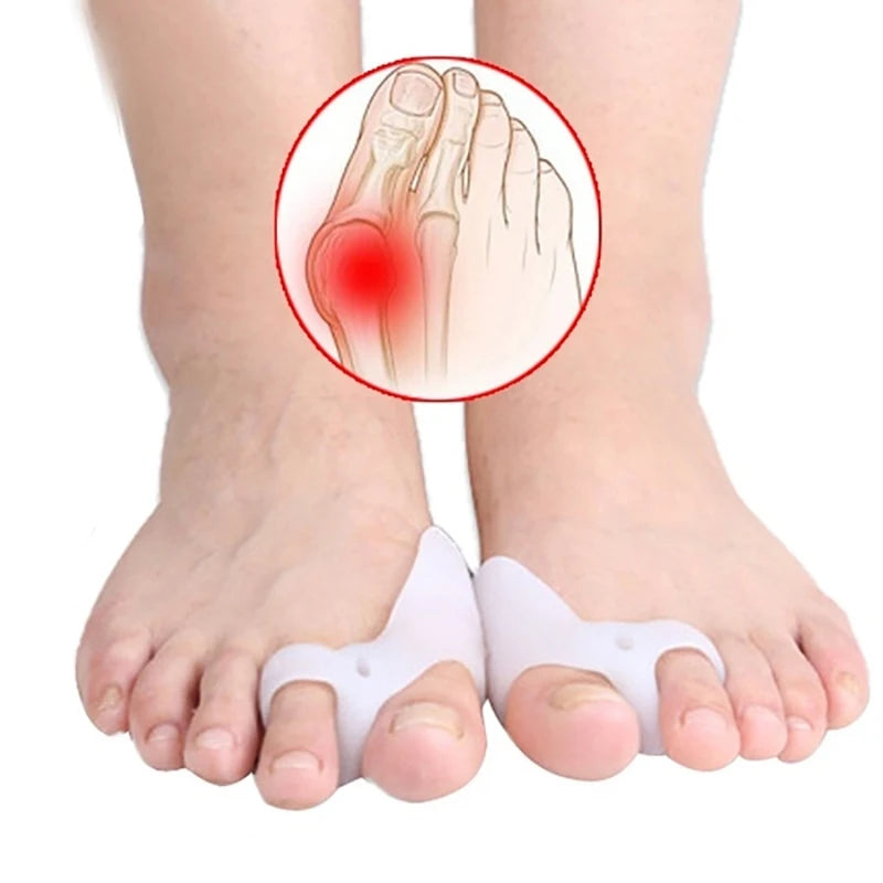 Par silikonskih korektora za prste za razdvajanje Hallux Valgusa