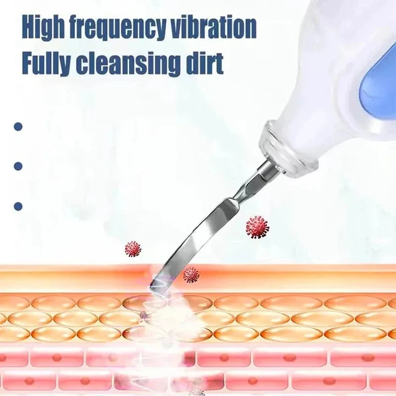 Portable Pore Cleansing Skin Scrubber &ndash; Ultrasonic Cleaning