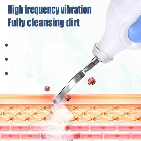 Portable Pore Cleansing Skin Scrubber &ndash; Ultrasonic Cleaning