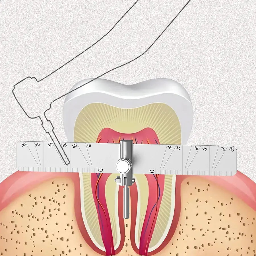 Dental Implant Locating Guide multi angle ruler Surgical Planting Locator Angle Ruler Guage Autoclavable by InterCyprus Trading Ltd