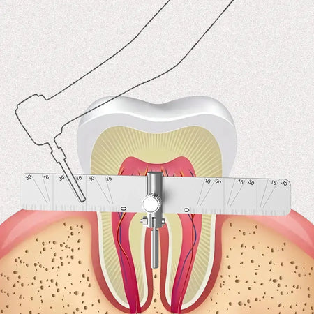 Dental Implant Locating Guide multi angle ruler Surgical Planting Locator Angle Ruler Guage Autoclavable by InterCyprus Trading Ltd