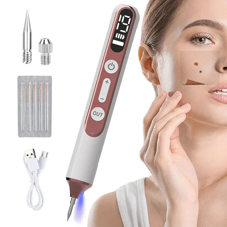 Skin Tag Remover Laser Plasma Pen &ndash; Warts Eliminator