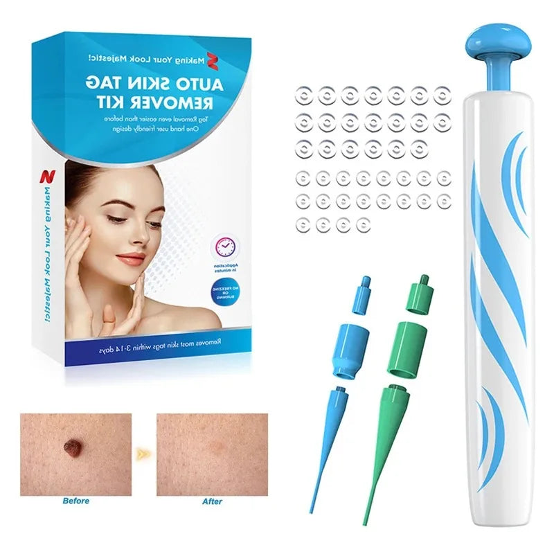 2-In-1 Auto Skin Tag Removal Tool Kit &ndash; Painless Pen