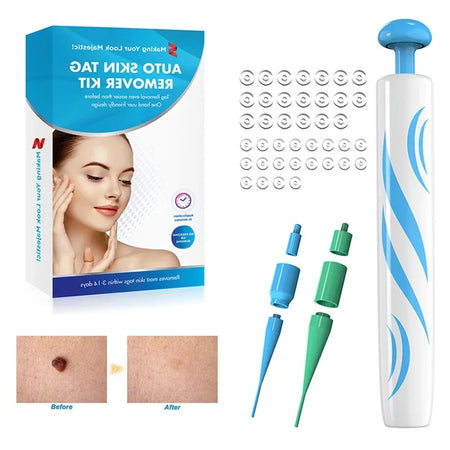 2-In-1 Auto Skin Tag Removal Tool Kit &ndash; Painless Pen
