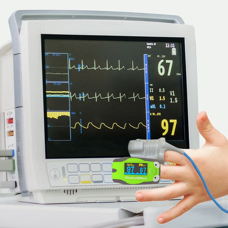 ChoiceMMed Children Finger Pulse Oximeter &ndash; OLED Display