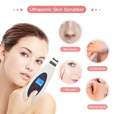Ultrasonic Skin Scrubber Cleanser &ndash; Deep Cleansing and Acne Removal