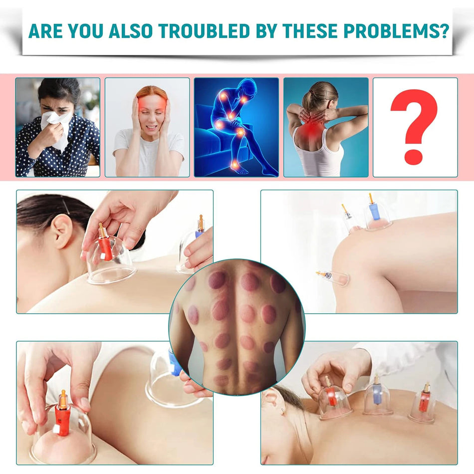 32-delige vacuüm cupping therapie set ventouse cups voor thuisgebruik