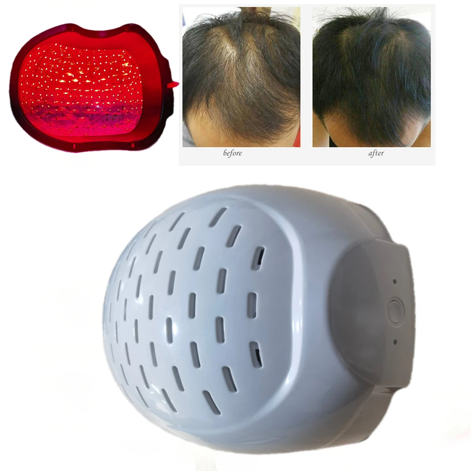 2025 Uuendatud Juuste Taastekork 210 LED Laser Kiiver C300