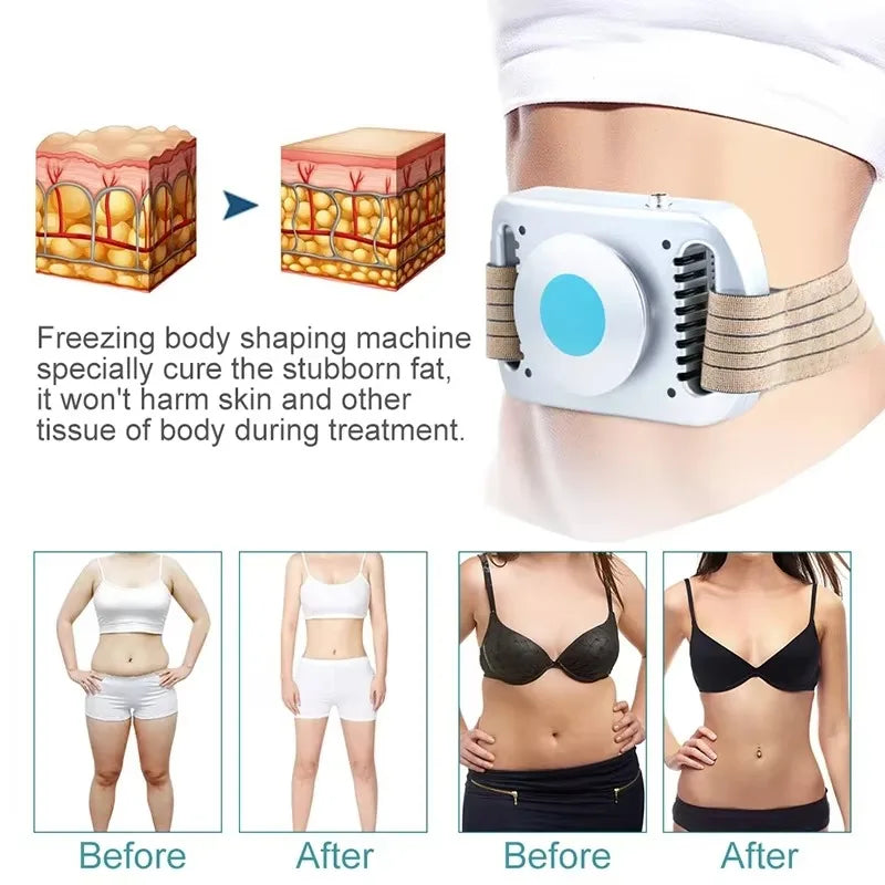 Vilnason Cryolipolysis Machine &ndash; Effective Fat Freezing for Body Slimming