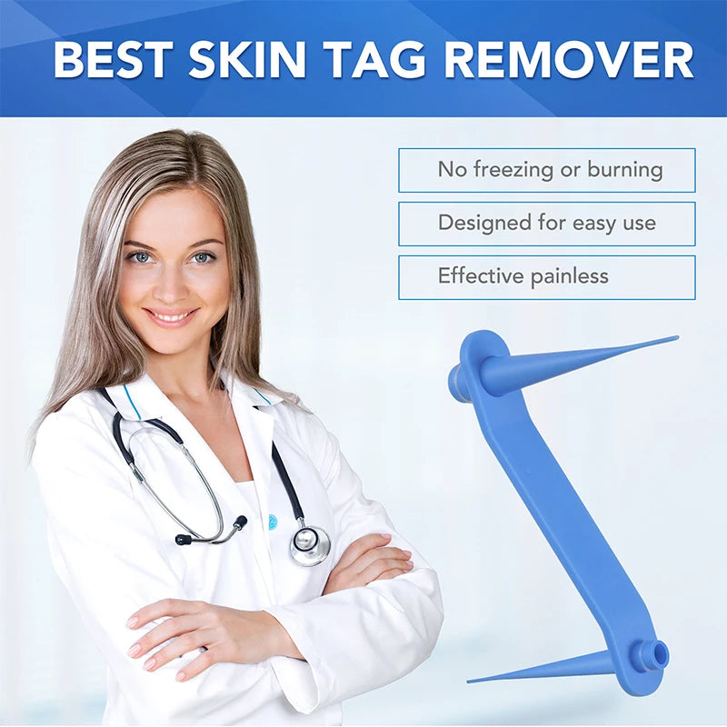 Acrylic Wart And Skin Tag Removal Tool For Skin Care
