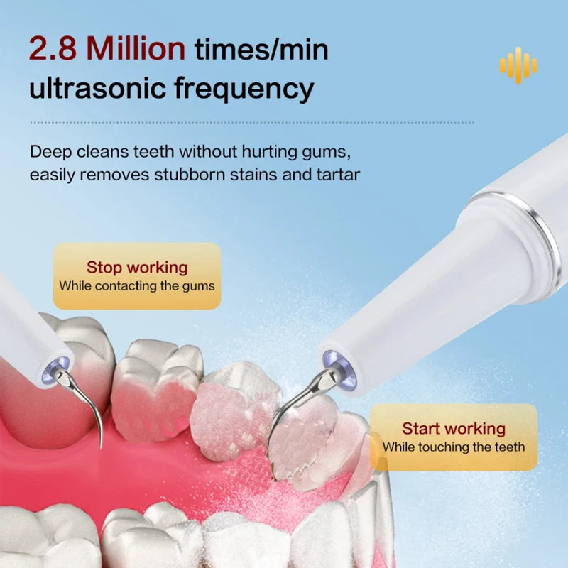 Xiaomi Youpin Ultrasonic Dental Scaler &ndash; High Frequency