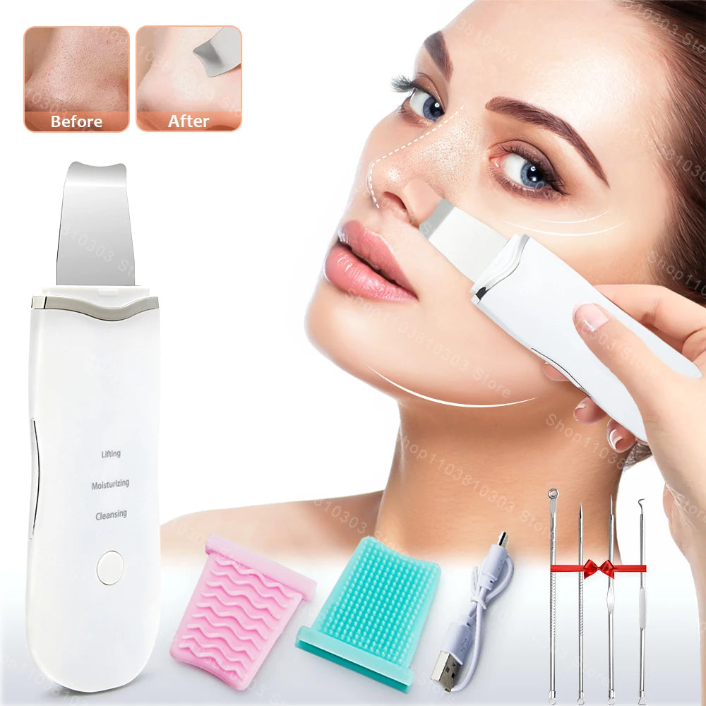 Electric Ultrasonic Skin Scrubber - Blackhead Remover &amp; Facial Lifting Tool