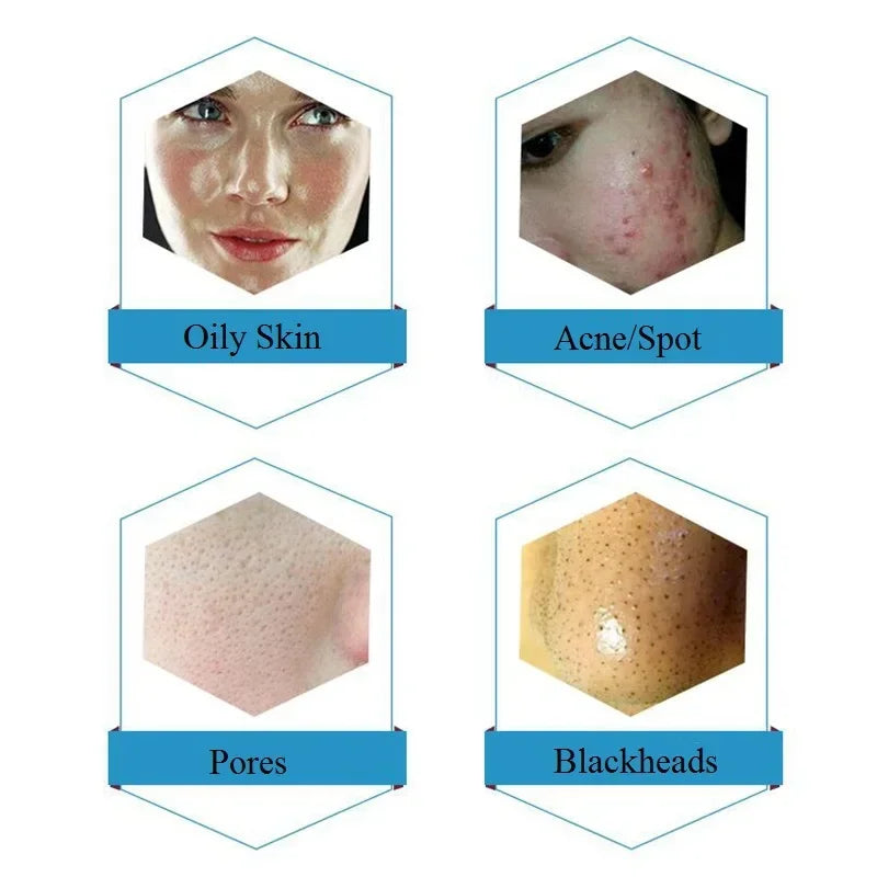 Professional Dermabrasion Serum Aqua 50ml &ndash; Deep Cleansing